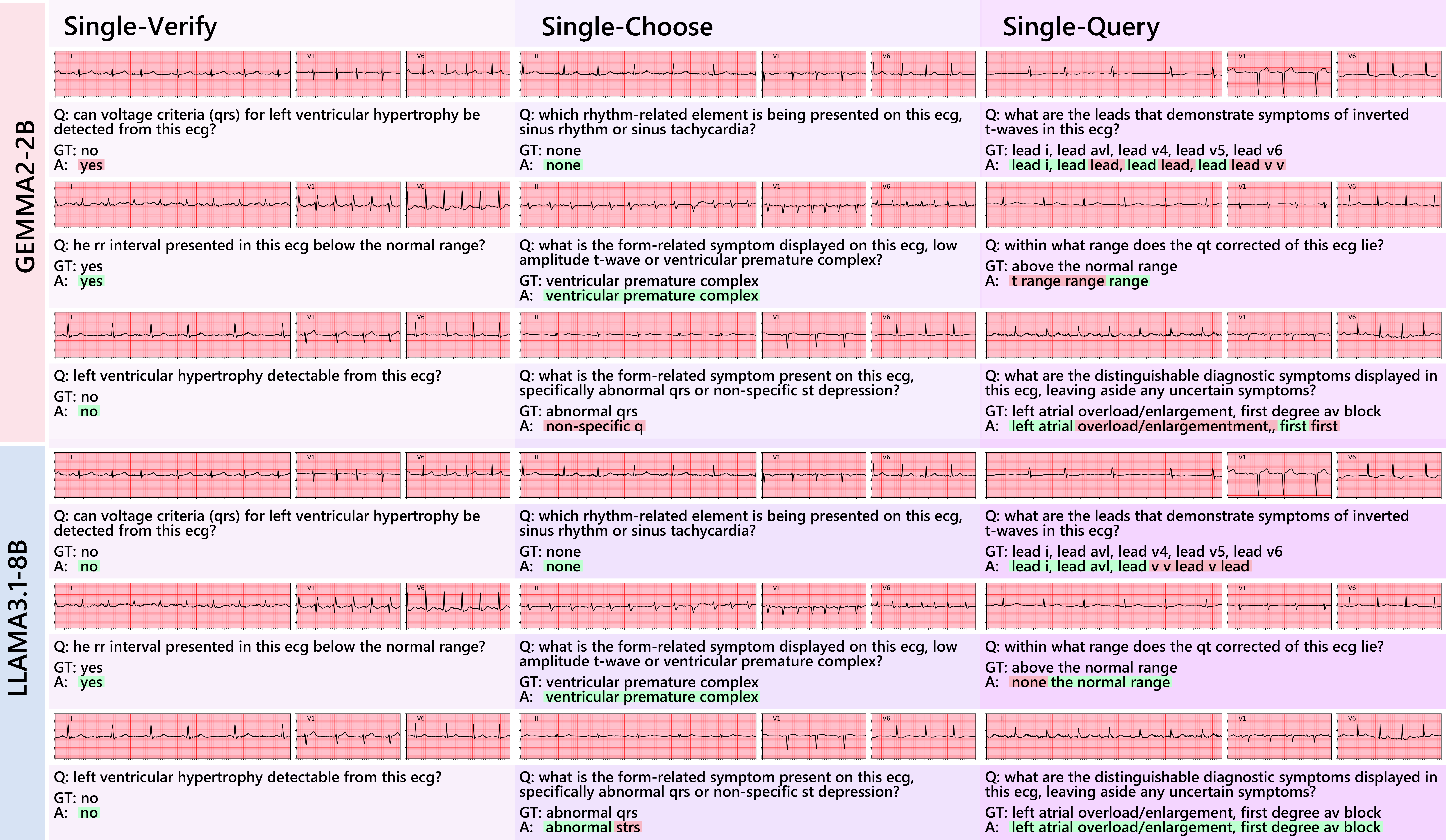 ecg_qa_examples